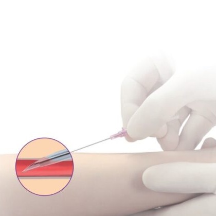 LocalShop24 - Inserimento ago cannula